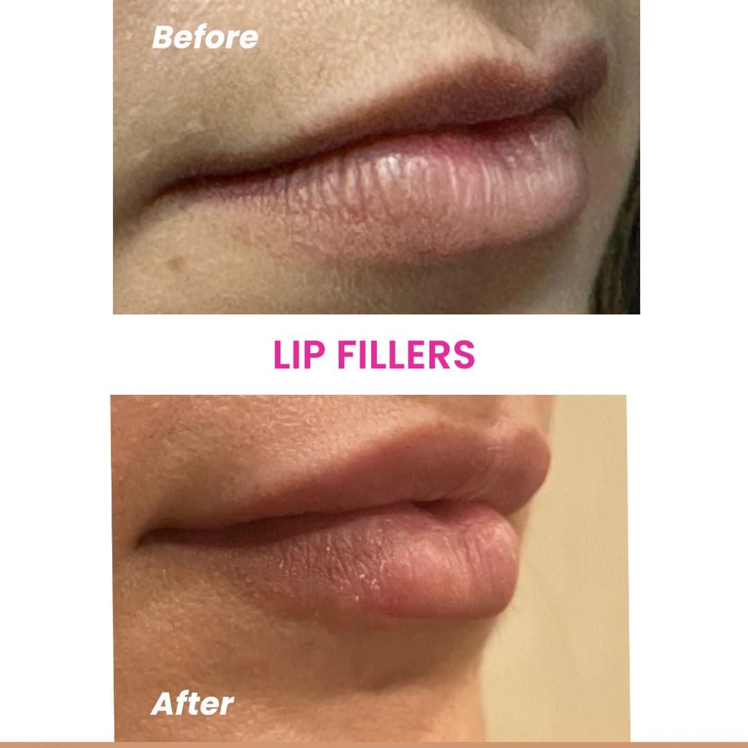 Before and After 3
