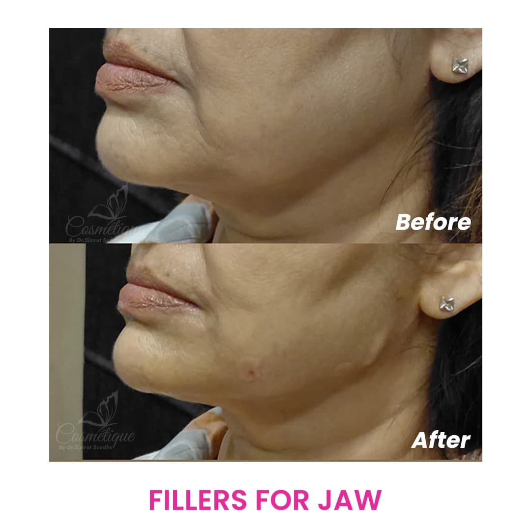 Before and After 6