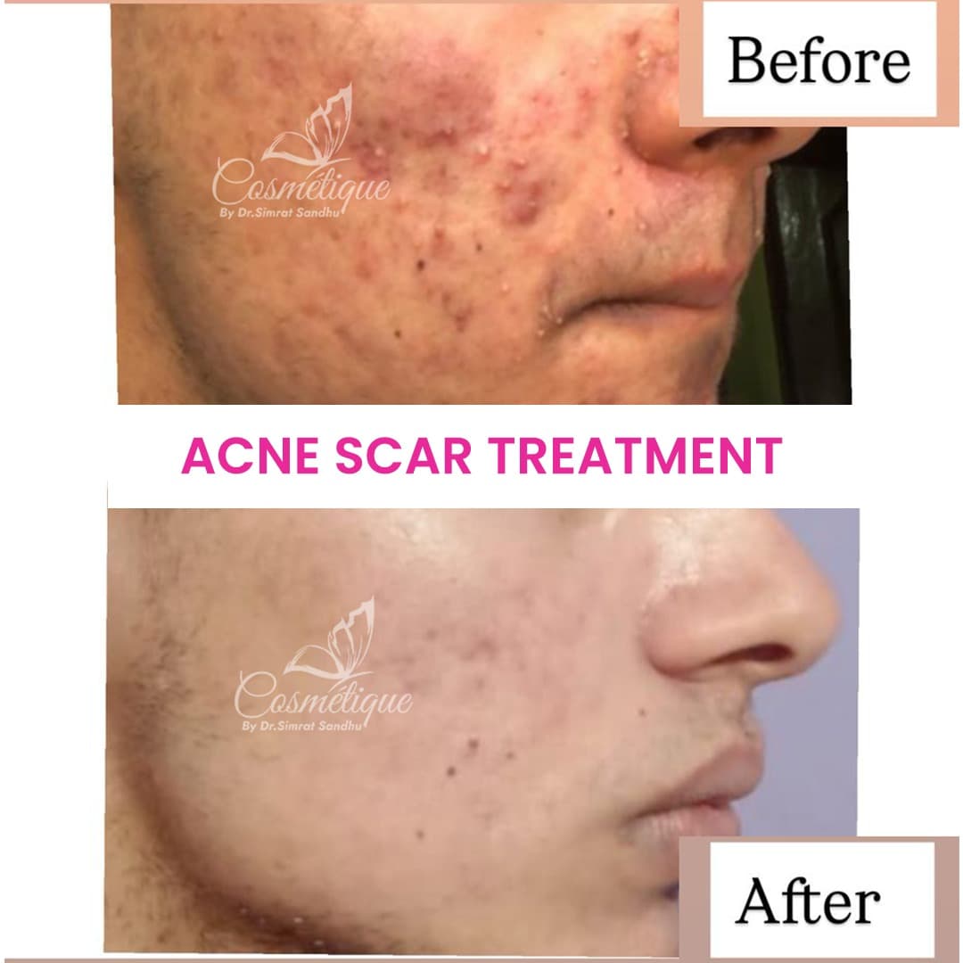 Before and After 7