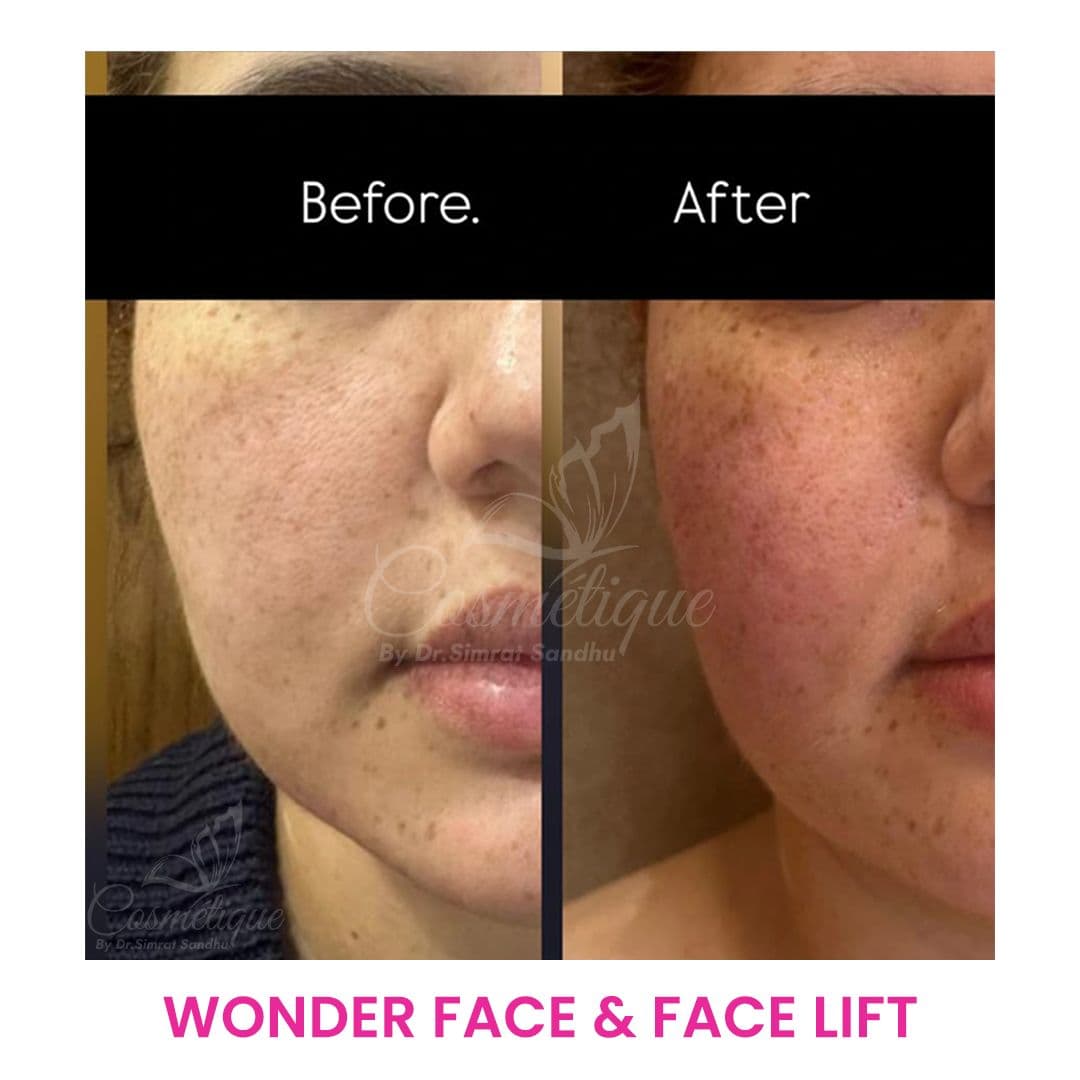 Before and After 9